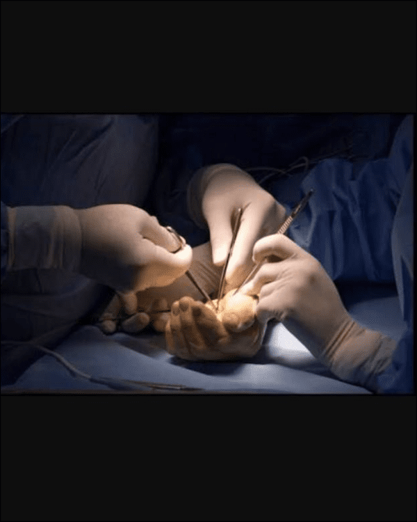Curso de Anatomía y Principios Quirúrgicos de la Mano - Imagen 3