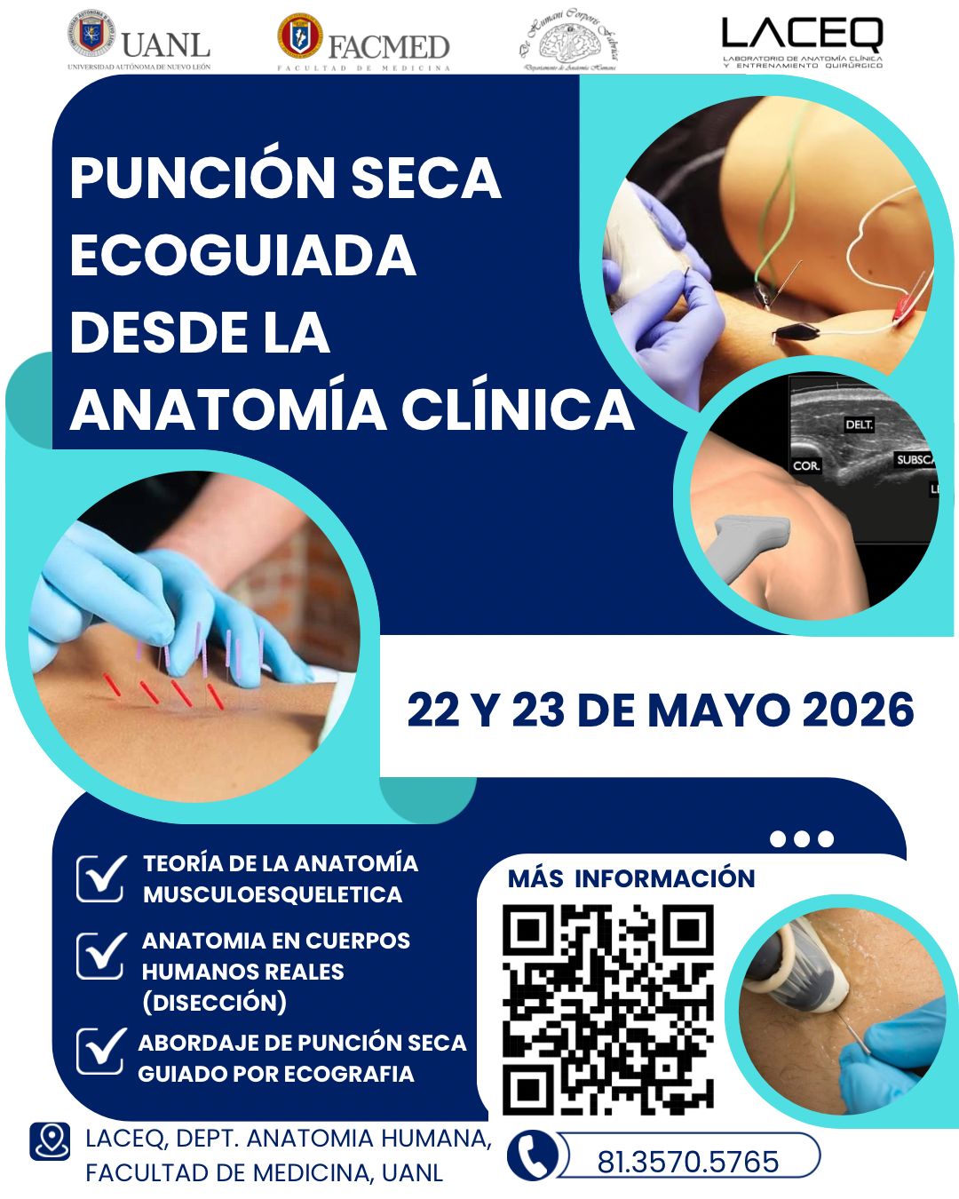 Curso de Punción Seca Ecoguiada - Imagen 2